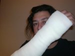 arm (Medium).jpg