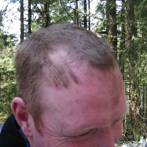 Tire marks on Rosco's Head