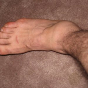 Ankle_002