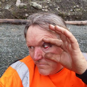 toms_branch_eye